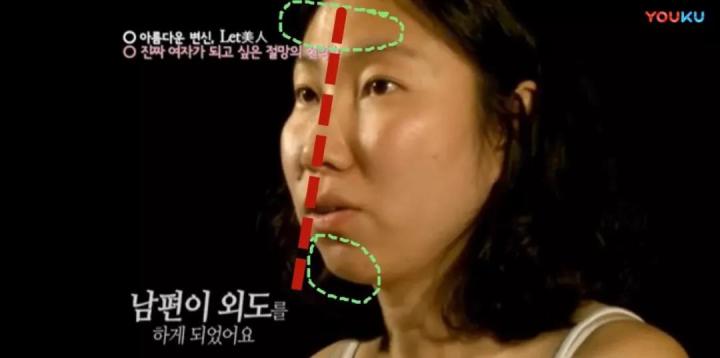 生完孩子被老公嫌弃太胖后续,生完孩子以后肚皮被老公嫌弃