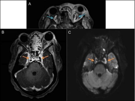 牙疼喉咙疼耳朵疼颈椎疼,小姐姐眼睛疼