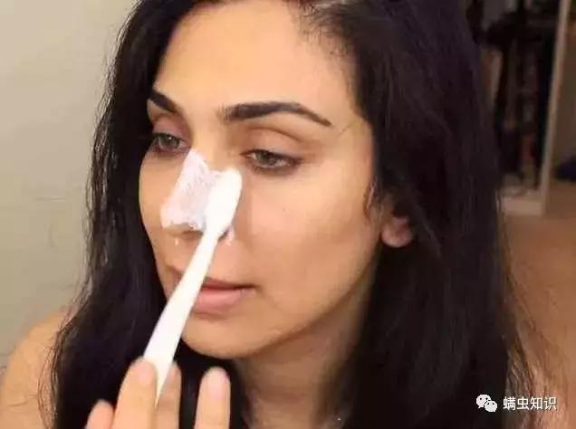 鼻子两侧黑头怎么处理,鼻子上有黑头应该注意些什么