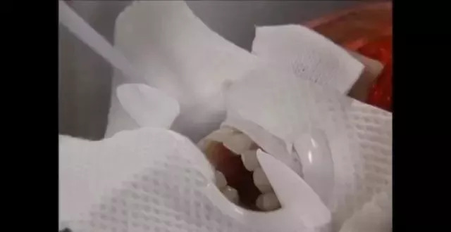 市面上冷光美牙仪真的有用吗,冷光美牙仪对牙齿伤害有多大