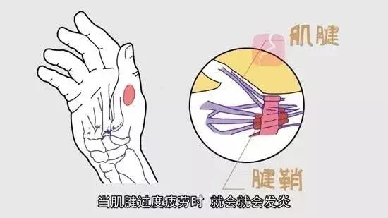 生完娃如何缓解全身疼痛,生完孩子感觉浑身没有力气