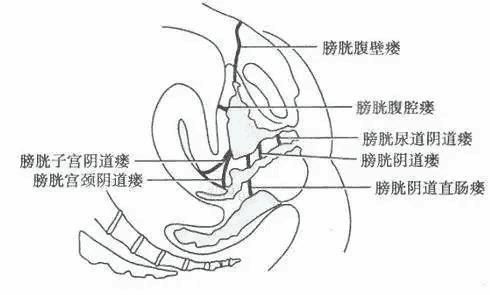 异常通道出现?年轻辣妈的烦心事儿