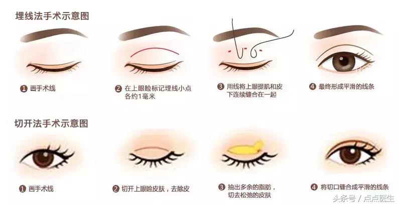 整容四大危险手术,整容的七大骗局