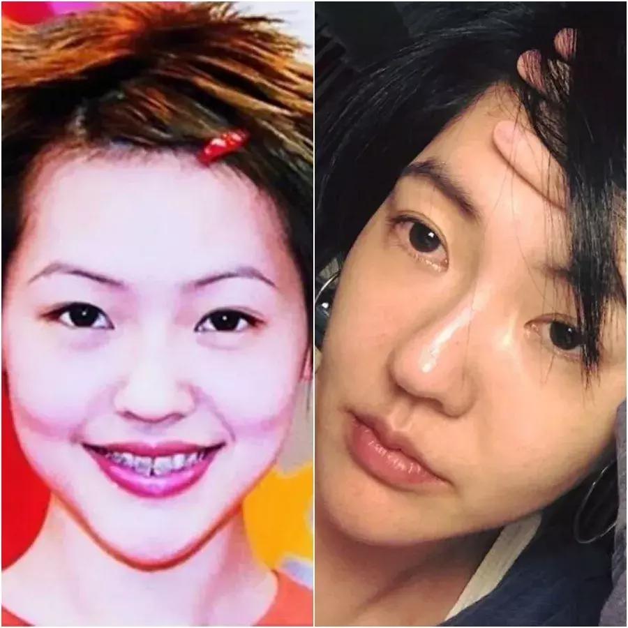 除了发量,最暴露年龄的可能是这两道纹