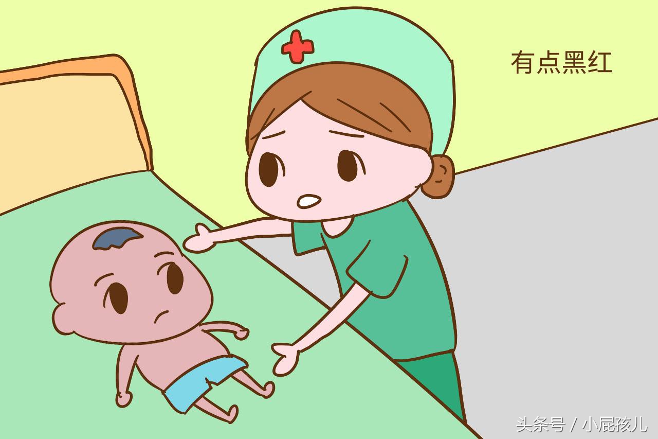 宝宝刚出生是不是都很丑,家里有个宝宝是真好吗