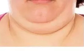 科普知识打鼾对心血管健康的危害,科普健康打呼噜