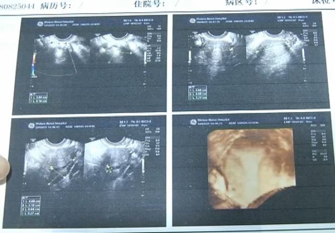 女孩12岁经期不正常是什么原因,22岁女孩月经不规律的原因