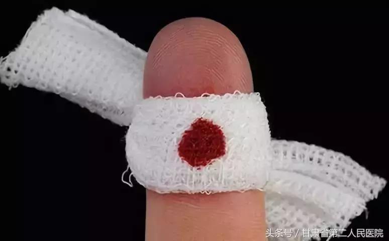 伤口感染破伤风的几率大吗,小伤口感染破伤风几率大不大