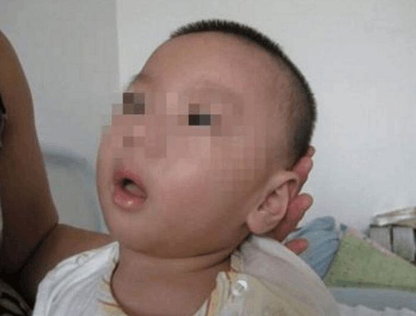 “凶手”藏在家里5年，导致8个月的孩子痴呆，这件事父母马虎不得