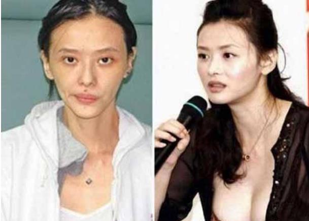 本是清纯女星却吸毒入狱，因小男友嫌“老”而整容直播时落泪！