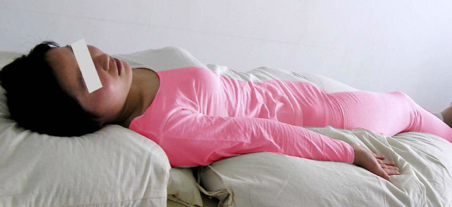 卒中康复训练教学,卒中患者早期康复的时间