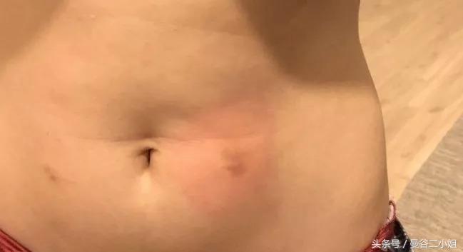 泰国冷冻卵子,泰国冻卵子