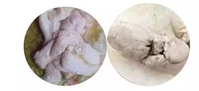 宝宝拉灰白屎,婴儿拉黄白色稀屎怎么办