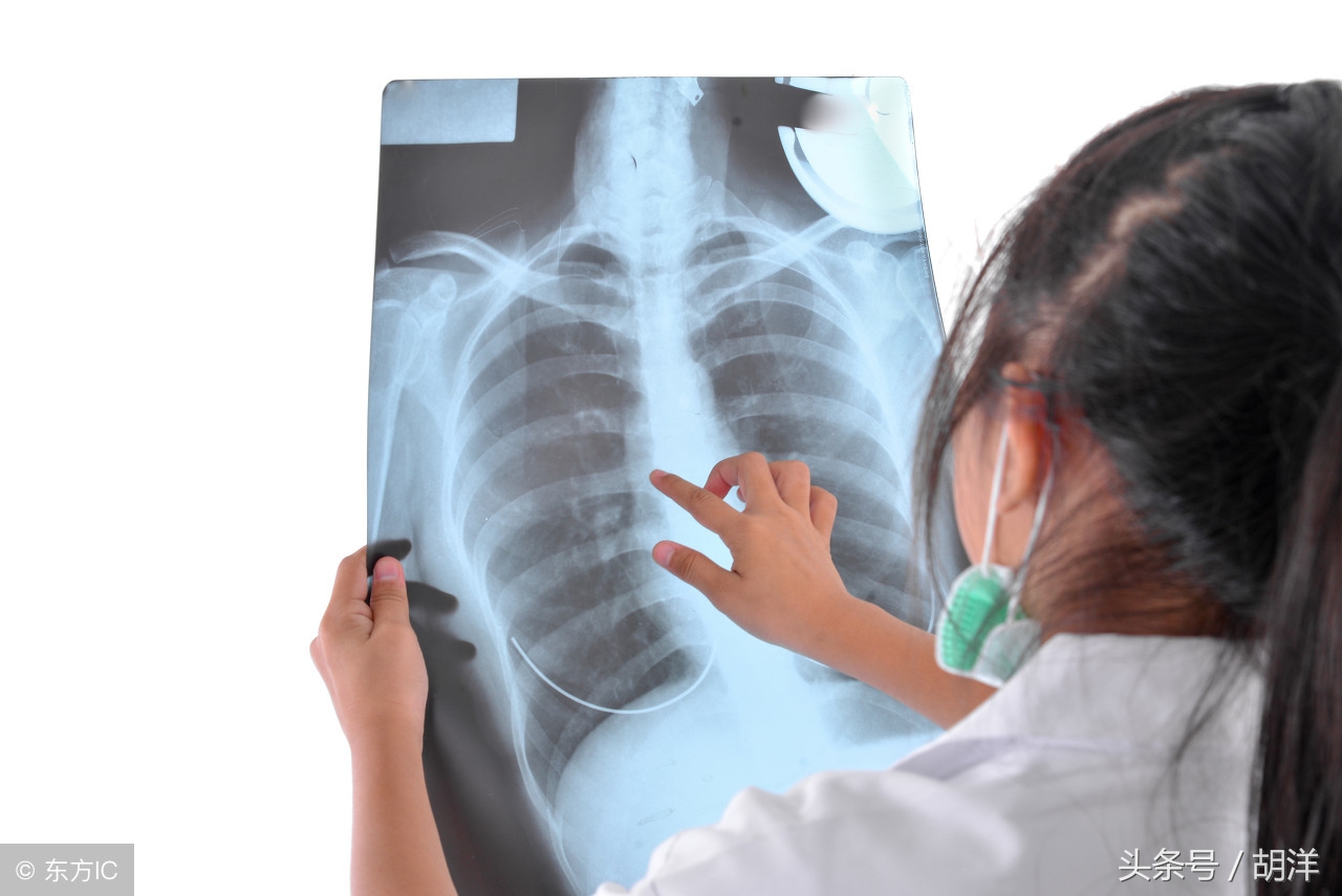 用什么机器能查出食管癌早期,医生一招搞定食管癌