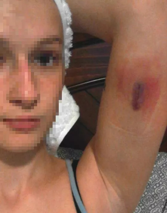 一根“火柴棒”就能避孕，而且还能消灭痛经？