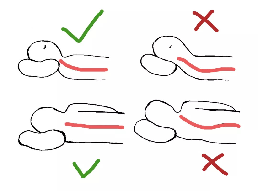 颈椎病猝死多少人,颈椎病死了多少人