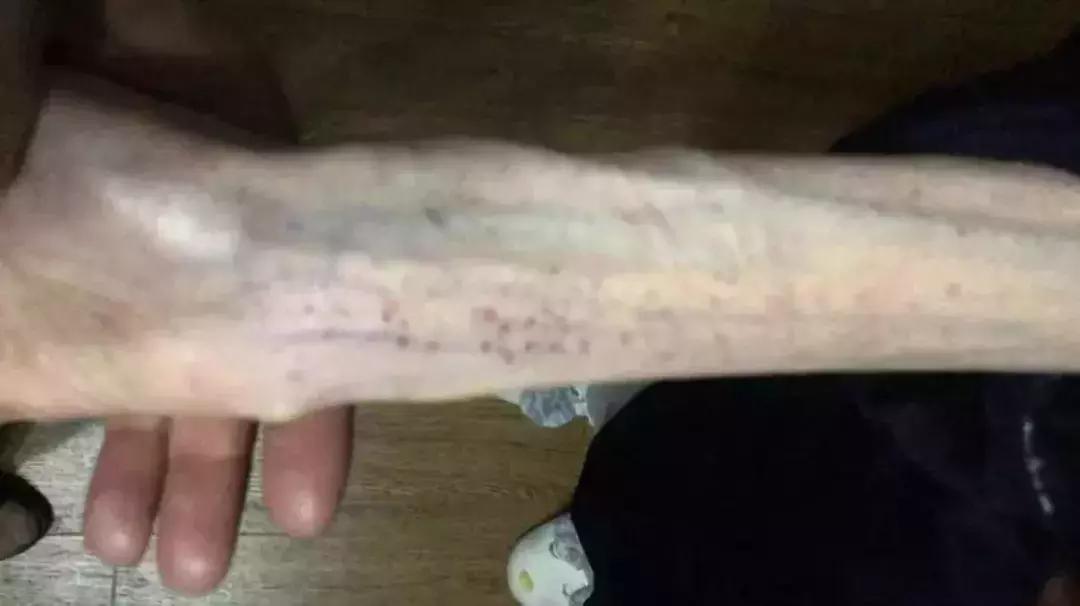 减肥毁掉我整个青春,年轻女性减肥的弊端