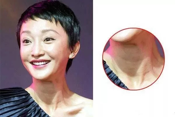 别低头肩颈会痛,低头颈纹很明显