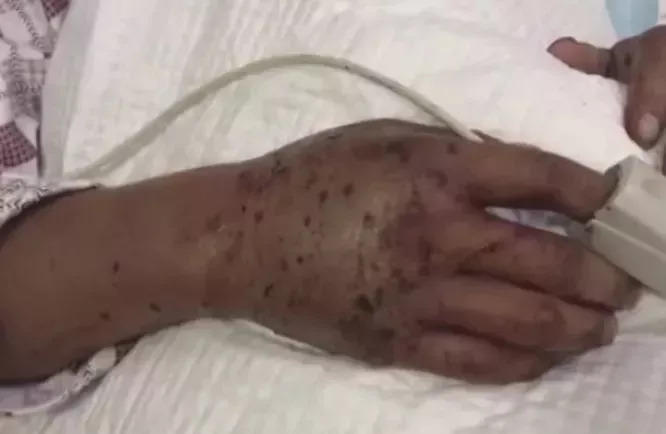 看到这几种东西千万不要捡,看到这些危险标志赶紧远离