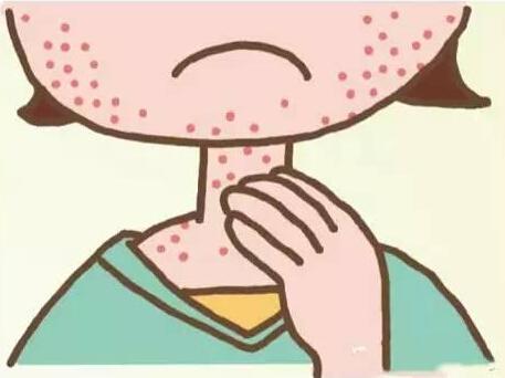 温州10岁男孩吃猕猴桃休克这些过敏原你意想不到