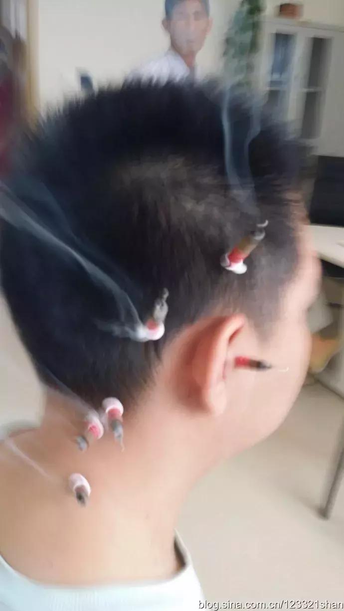 儿童近视有效的三个方法,儿童近视的四大误区