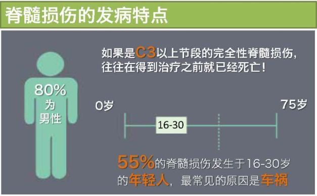 2021干细胞治疗脊髓损伤临床案例,干细胞治疗脊髓损伤最新临床试验