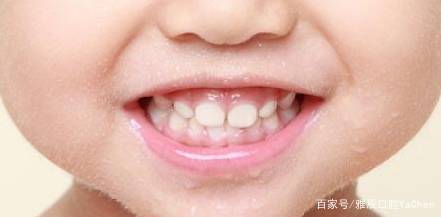 智齿为什么疼的时候不能拔,智齿疼为什么不能拔