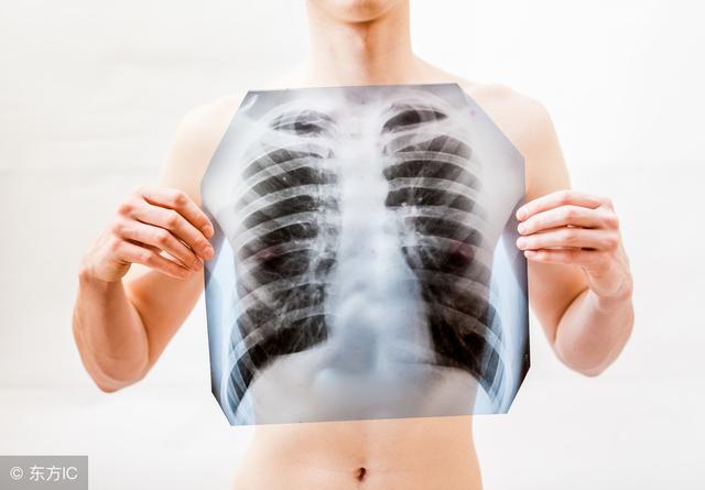 x光片放家里有危害吗,废旧的x光片对人体伤害多大