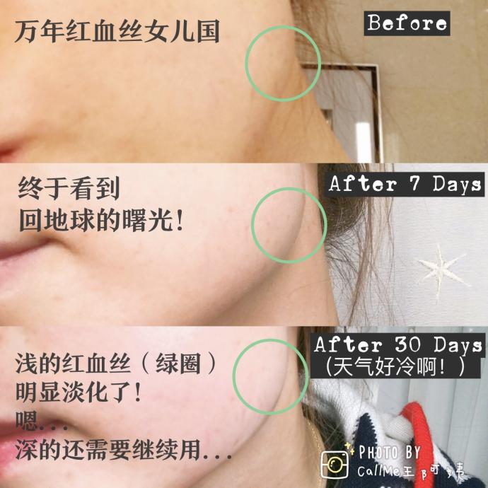 安瓶的五大真相,最好的安瓶有哪些