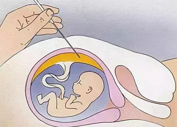 孕妈产检必备攻略，一定要收藏！