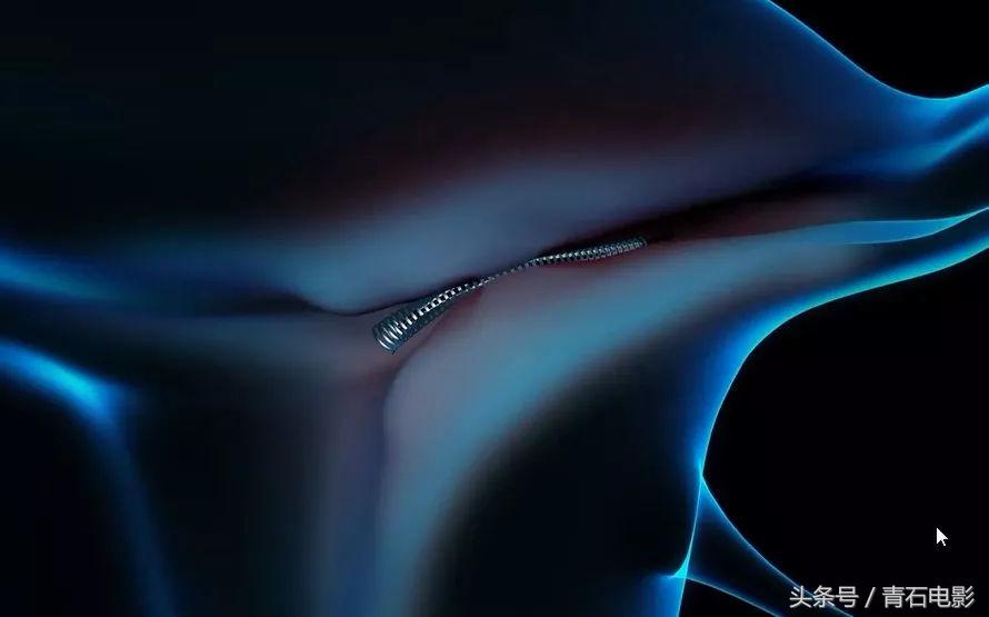 网飞出品的纪录片，上映后让美公司停售一款尖端医疗器械！