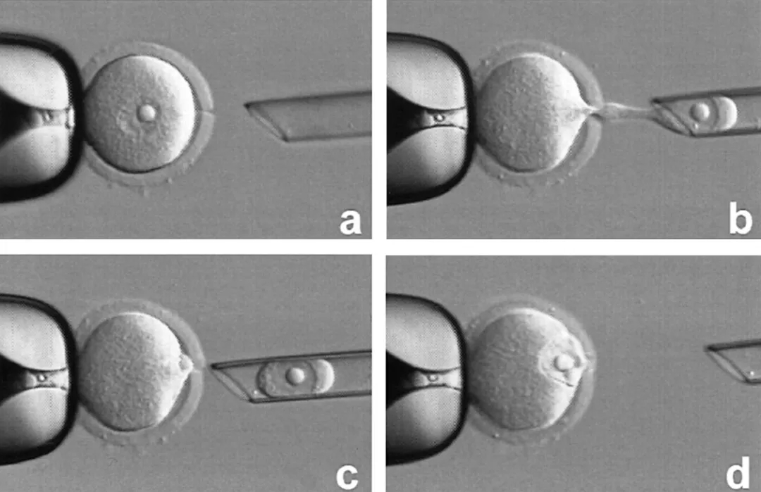 关于试管婴儿你会想知道的事,试管婴儿100问