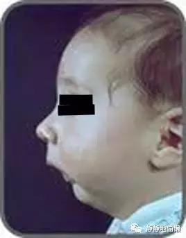 打呼噜怕影响别人不敢睡,打呼噜吸气有声呼气没声