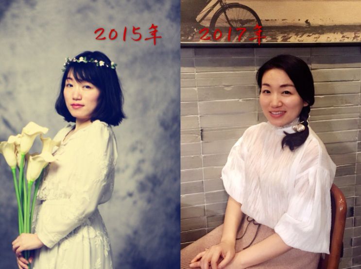 返场预告|第一次降价，Tripollar童颜机重塑脸部胶原，效果堪比医美级，如果一生只选一样美容品，必须就是它！