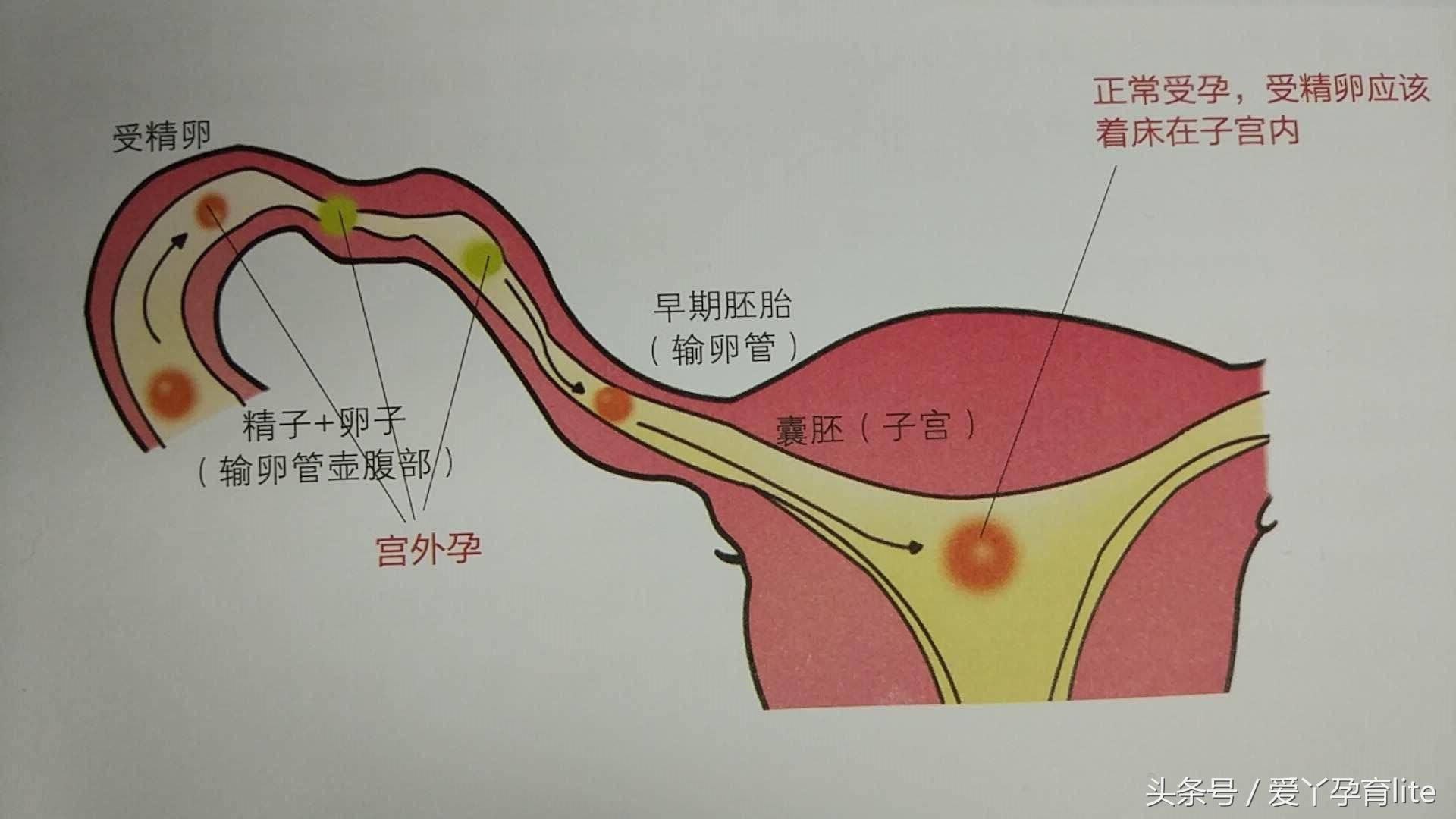 30岁孕妈该注意事项,高龄孕妇怀孕1个月成功率