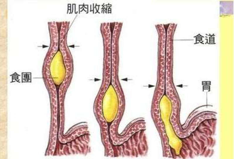 糖尿病的并发症信号,糖尿病并发症的信号是什么