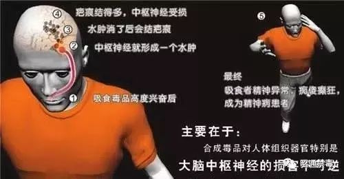 全民禁毒远离毒物,珍爱生命禁毒防艾知识