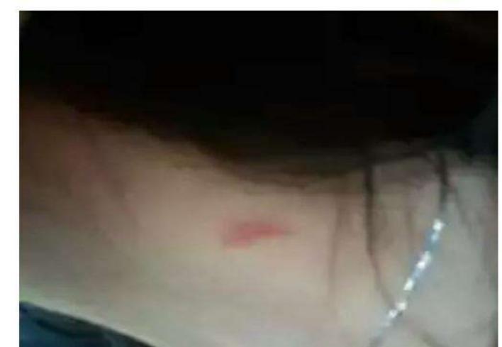 女友脖子上有“草莓”,男友眼看要着急了,这时候猫咪解救了女友