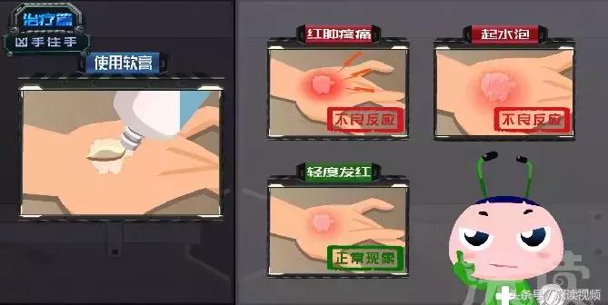 激光治疗和皮肤移植哪家强？治疗白癜风，最新黑科技大盘点