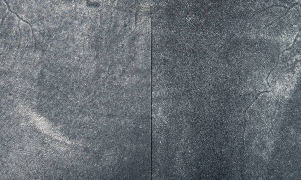 大理石细微裂纹修补,龙岗大理石裂纹修补店面