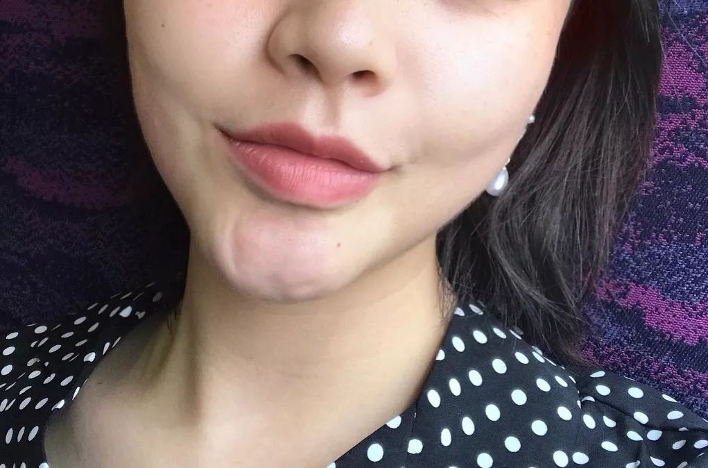 澳洲美白丸效果好吗,澳洲美白丸有用吗