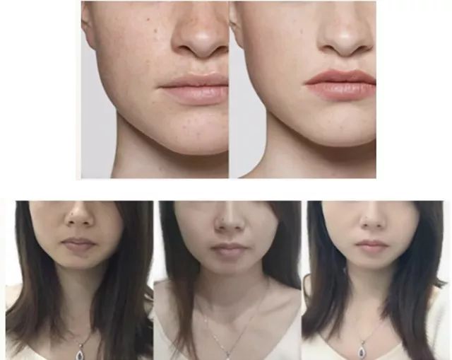 澳洲美白丸推荐,澳洲美白丸真实测评