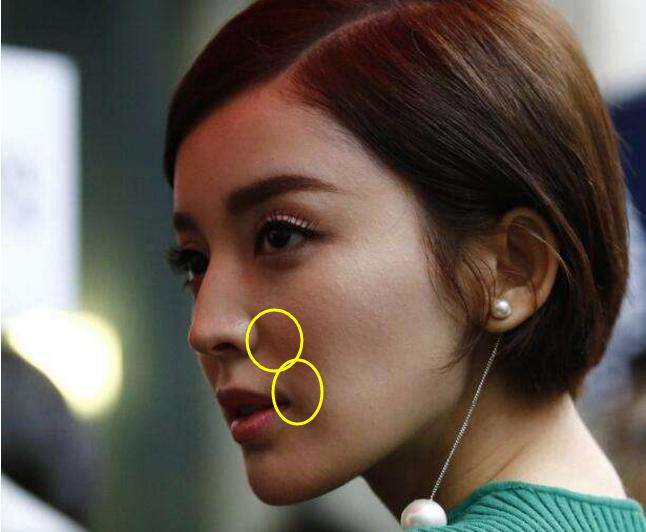 据说爱笑的女孩子法令纹特别重,爱笑的女孩法令纹都不会太少