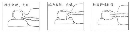 颈椎病患者需要选择什么样的枕头,颈椎病不枕枕头睡觉的好处与弊端