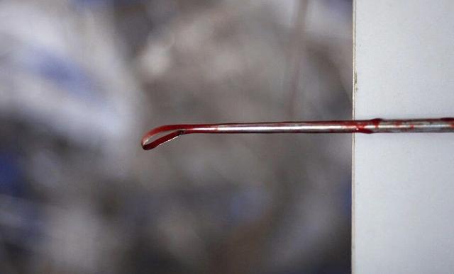 平时如何避孕,平时大家怎么避孕