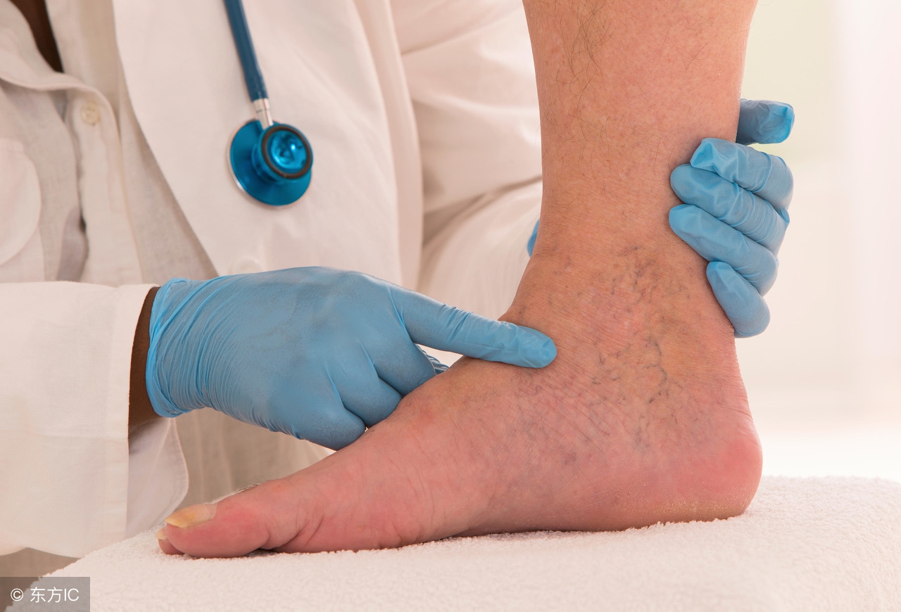 血管斑块堵住血管还能疏通开吗,小血管堵住没事大血管堵住没治