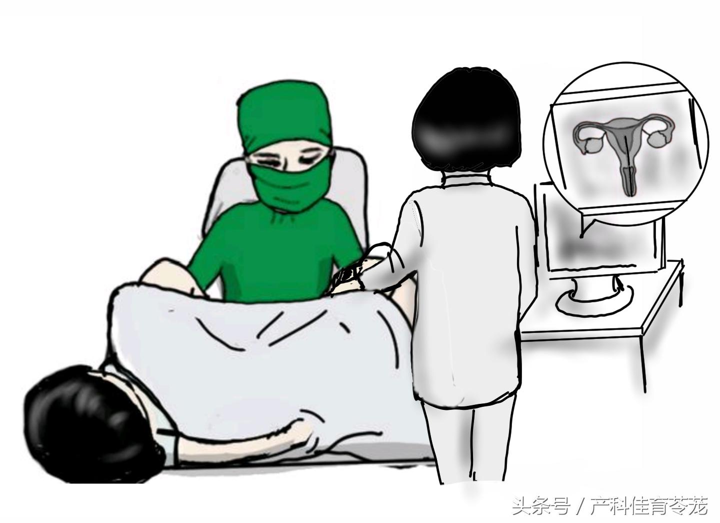 女性出血警惕癌症,绒癌出血能止住吗