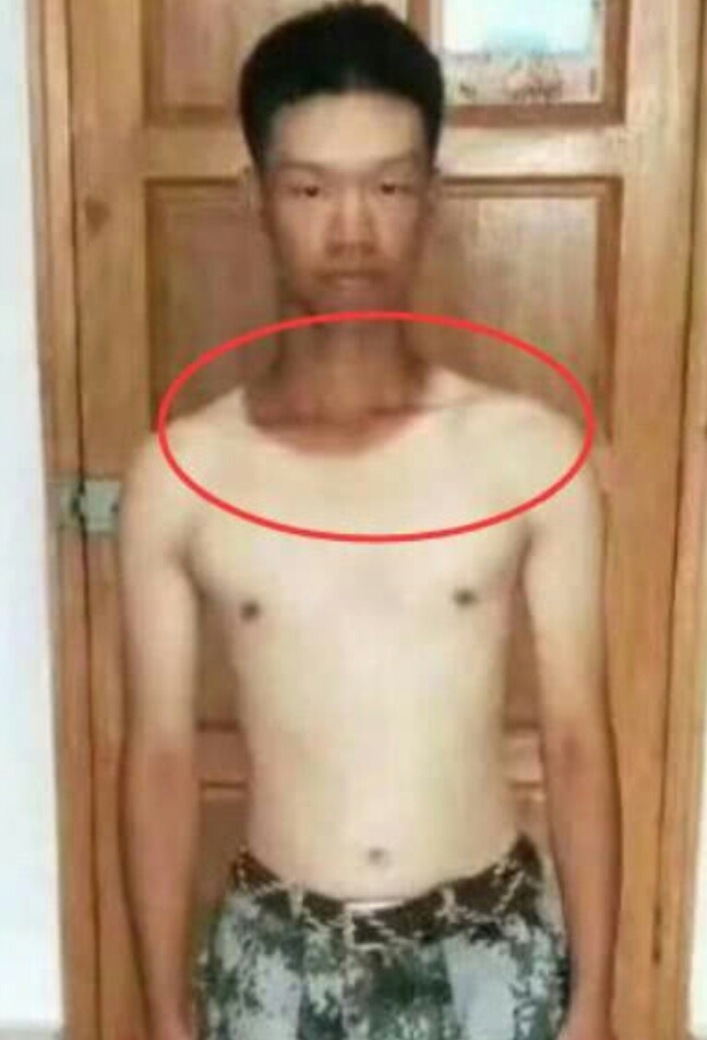 军训怎么才能走整齐,军训后最快白回来的方法