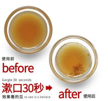 刷牙真的可以清除食物残渣吗,刷牙只能清除20%的口腔细菌