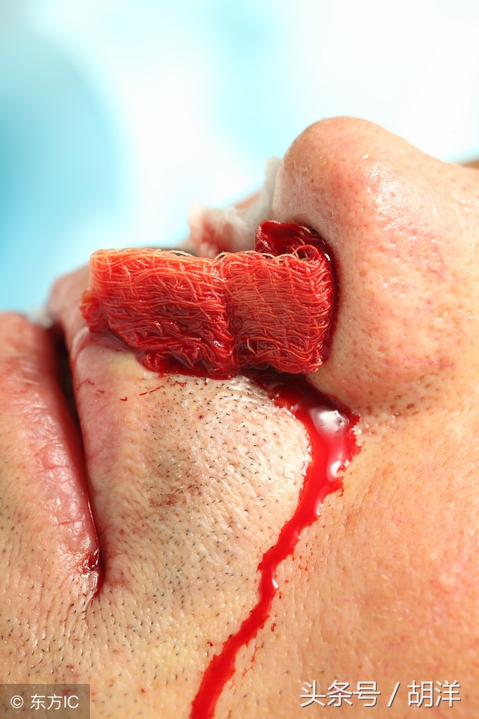 癌症特效靶向药有哪些副反应,发生副反应后如何处理,怎么避免